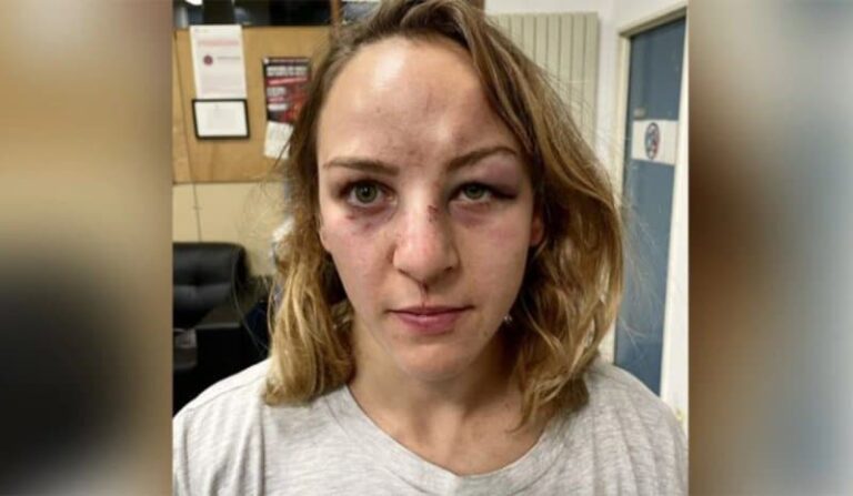 Γαλλία: Η αθλήτρια Μαργκό Πινό κατήγγειλε τον σύντροφό της για ξυλοδαρμό – «Νόμιζα ότι πέθαινα»