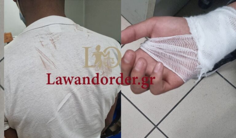 Αποκλειστικό L&O:  Πακιστανοί λήστεψαν και «σακάτεψαν» στο ξύλο τουρίστα από τη Ν.Αφρική