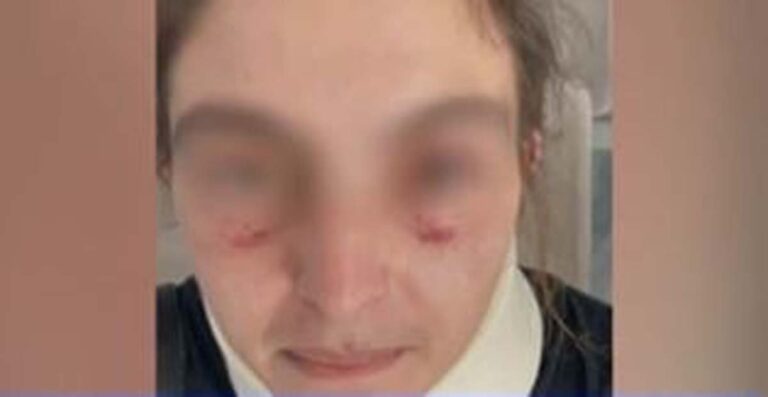 Κόρινθος: Είχε χτυπήσει και στο παρελθόν την πρώην σύζυγό του ο 33χρονος που κατηγορείται ότι την απήγαγε και τη βίασε (βίντεο)