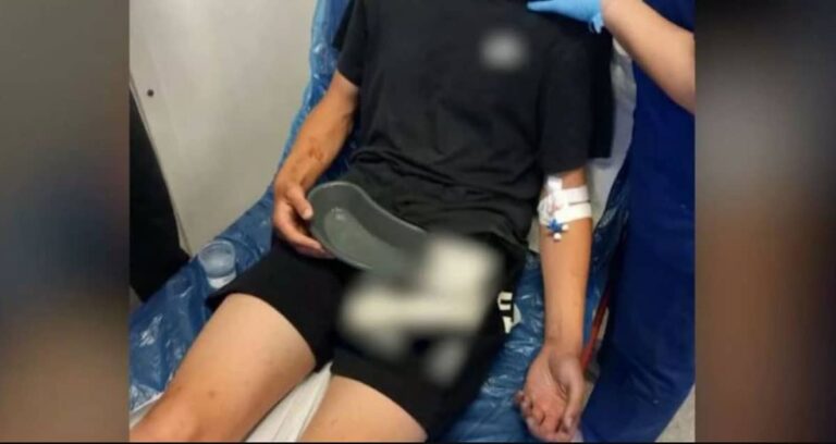 Καλαμάτα: «Του είπαν ότι δεν έχουν τελειώσει μαζί του» – Ξεσπά η μητέρα του 16χρονου που ξυλοκοπήθηκε από συμμορία ανηλίκων (βίντεο)