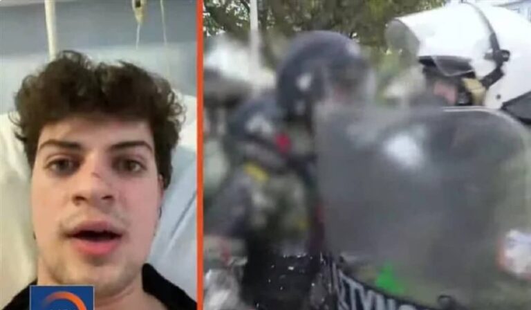 Φοιτητής καταγγέλει αστυνομική βία στην πορεία για τα Τέμπη: «Με χτύπησε κουτουλιά με το κράνος» (βίντεο)