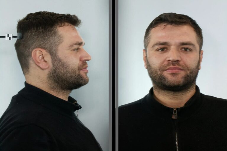 Νέα Σμύρνη: Αυτός είναι ο 36χρονος που έκλεβε πορτοφόλια στο τραμ (εικόνες)