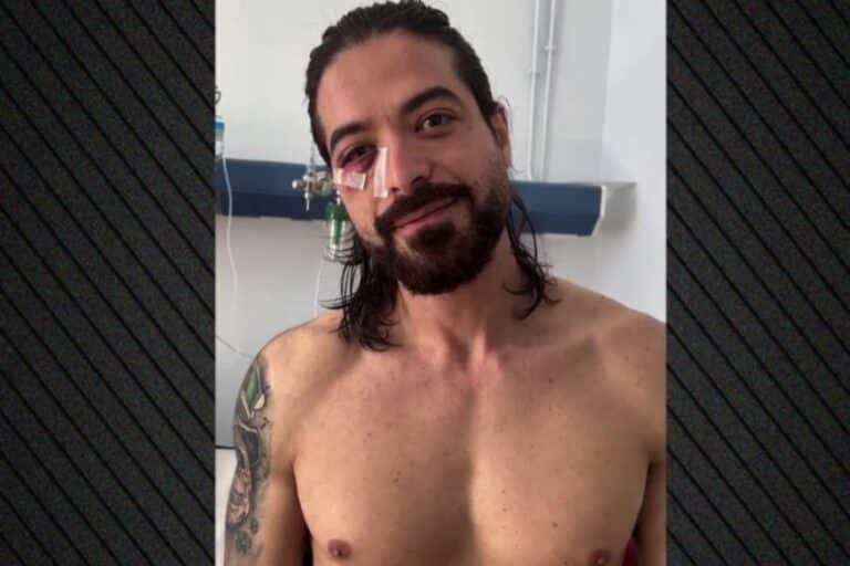 Άρης Μουγκοπέτρος: Έχασε πλήρως την όρασή του από το δεξί μάτι – Μπαίνει εσπευσμένα στο χειρουργείο (βίντεο)