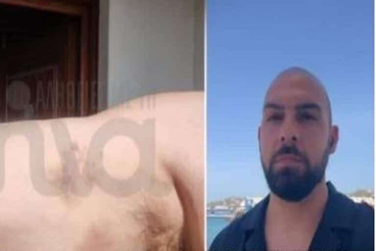 Μύκονος: 45χρονος υπέστη υπογλυκαιμικό σοκ και ξυλοκοπήθηκε από αστυνομικούς που τον πέρασαν για τοξικομανή – «Διαστρέβλωση των γεγονότων» απαντά η ΕΛ.ΑΣ