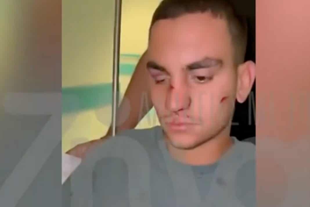 Ο 19χρονος που έπεσε θύμα ξυλοδαρμού στη Χαλκίδα