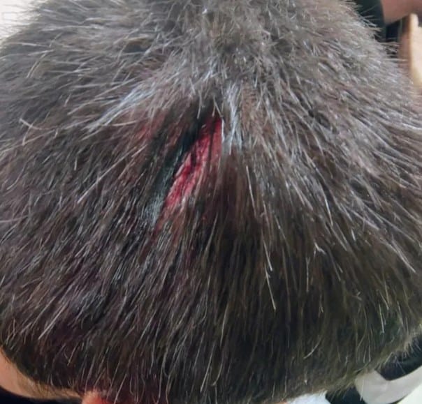 diadilotis epeisodia