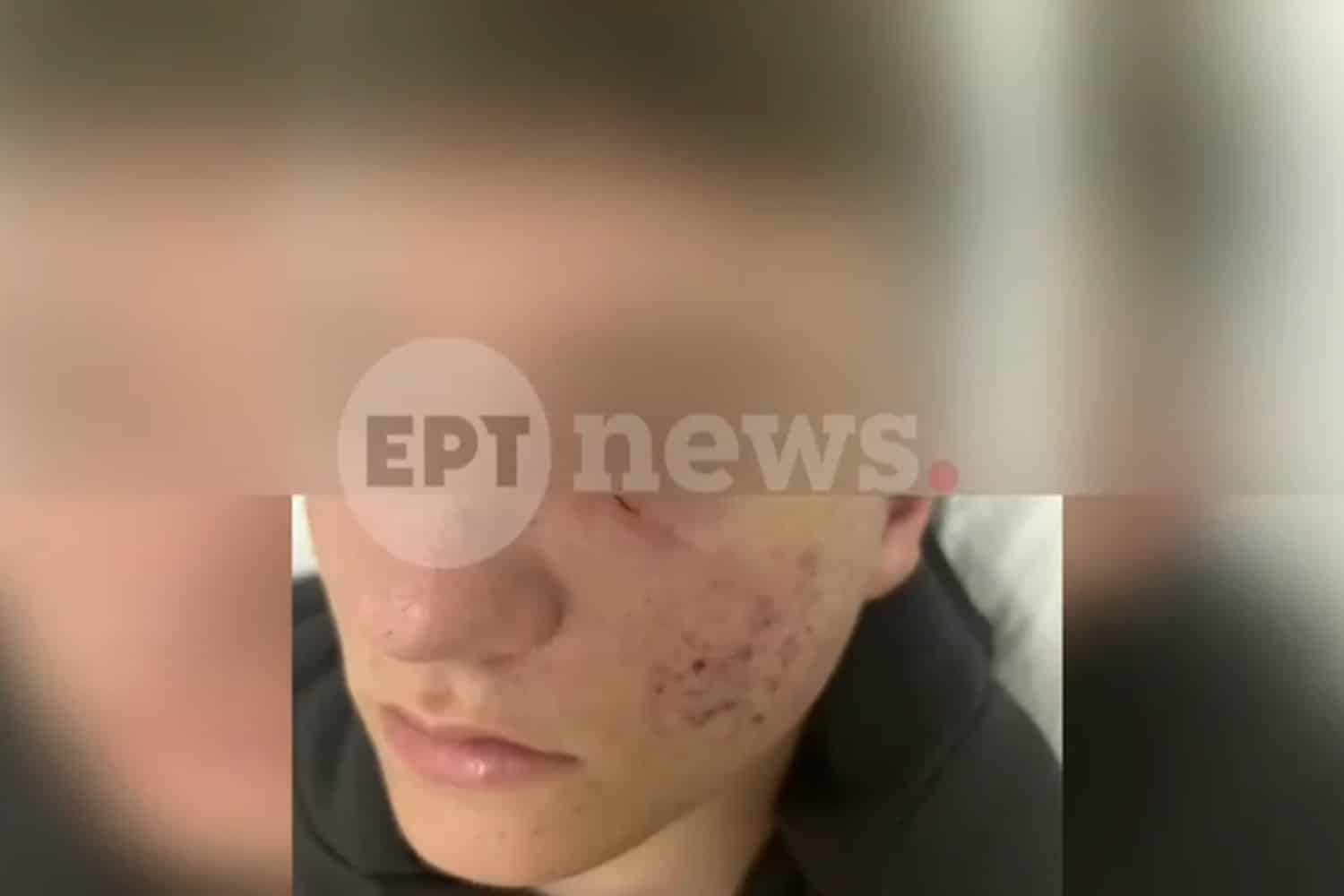 15xronos xanthi 12 11 2025