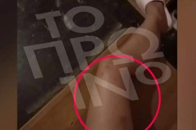 Νέα υπόθεση ενδοοικογενειακής βίας: 19χρονη καταγγέλλει τον πρώην σύντροφό της για ξυλοδαρμό – «Πονάω, γιατί με χτύπησες;» (βίντεο)
