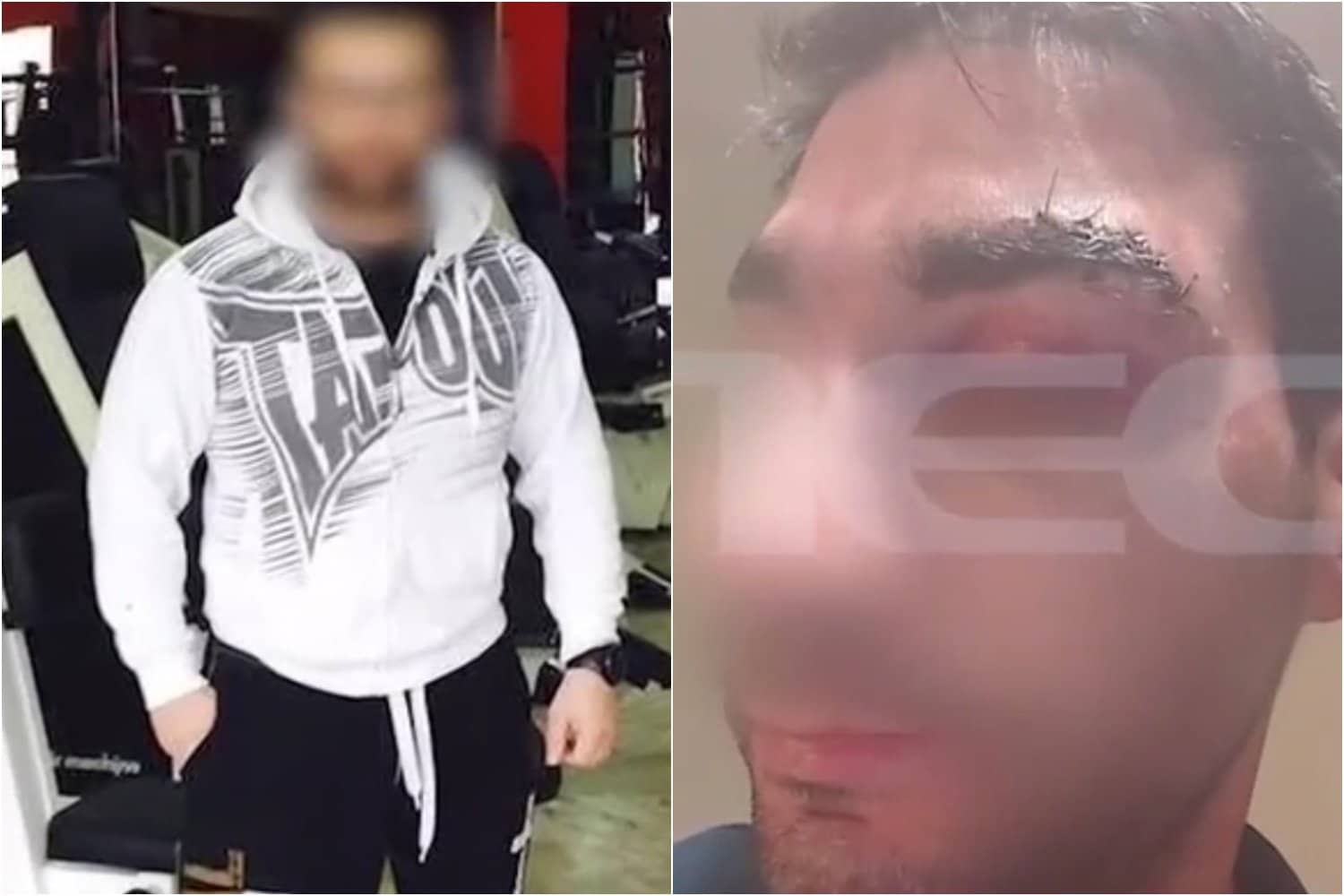 aigio giatros boxer ksilodarmos 14 12