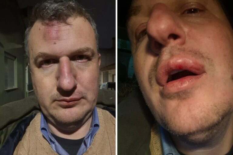 Ξεσπούν στα social media μετά την άγρια επίθεση στον εκδότη της «Μαγνησίας» – «Συνεχίζω άτεγκτος»