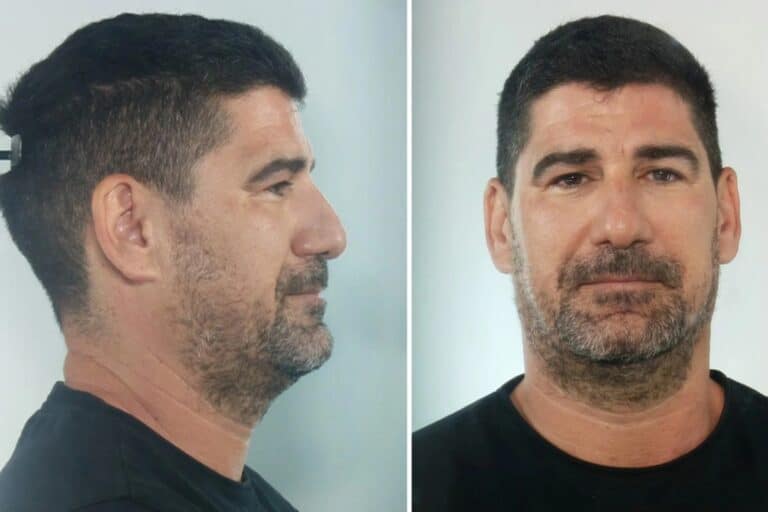 Κεφαλονιά: Αυτός είναι ο προπονητής που διώκεται για κατ’ εξακολούθηση βιασμούς ανήλικων αθλητριών